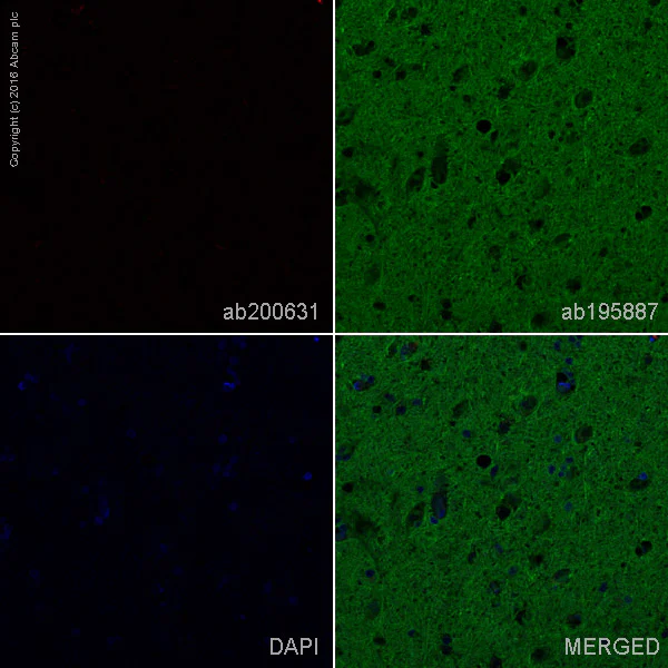 Immunohistochemistry (Formalin/PFA-fixed paraffin-embedded sections) - Alexa Fluor® 647 Anti-Human Kappa Chain antibody [EPR5539-71-8] (AB200631)