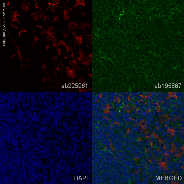 Immunohistochemistry (Formalin/PFA-fixed paraffin-embedded sections) - Alexa Fluor® 647 Anti-Iba1 antibody [EPR16588] (AB225261), expandable thumbnail