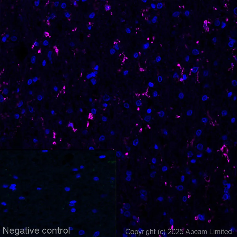 Immunohistochemistry (Formalin/PFA-fixed paraffin-embedded sections) - Alexa Fluor® 647 Anti-Iba1 antibody [EPR16588] - Microglia marker (AB225261)