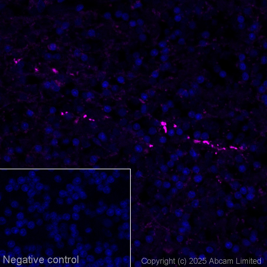 Immunohistochemistry (Formalin/PFA-fixed paraffin-embedded sections) - Alexa Fluor® 647 Anti-Iba1 antibody [EPR16588] - Microglia marker (AB225261)