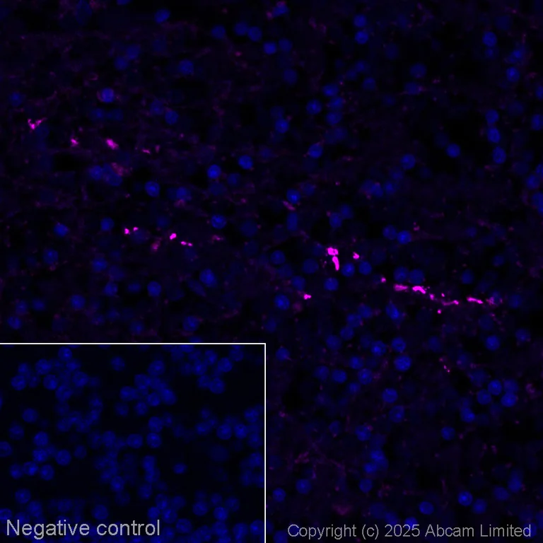 Immunohistochemistry (Formalin/PFA-fixed paraffin-embedded sections) - Alexa Fluor® 647 Anti-Iba1 antibody [EPR16588] - Microglia marker (AB225261)