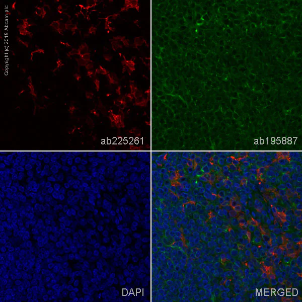 Immunohistochemistry (Formalin/PFA-fixed paraffin-embedded sections) - Alexa Fluor® 647 Anti-Iba1 antibody [EPR16588] - Microglia marker (AB225261)