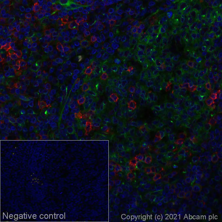 Immunohistochemistry (Formalin/PFA-fixed paraffin-embedded sections) - Alexa Fluor® 647 Anti-ICOS antibody [EPR20560] (AB281317)