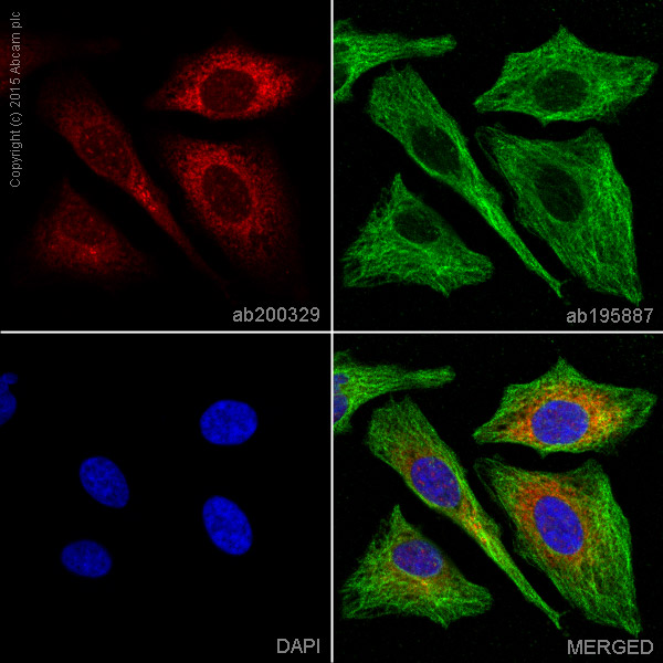 Immunocytochemistry/ Immunofluorescence - Alexa Fluor® 647 Anti-IFNGR1 antibody [EPR7866] (AB200329)