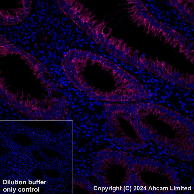 Immunohistochemistry (Formalin/PFA-fixed paraffin-embedded sections) - Alexa Fluor® 647 Anti-IGF2BP2/IMP-2 antibody [EPR6741(B)] (AB322024)