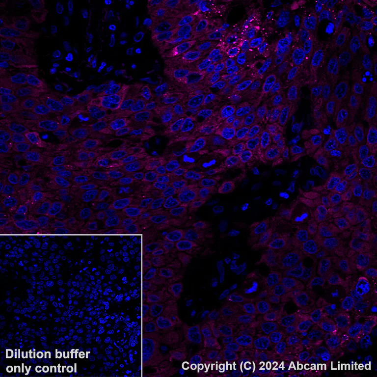 Immunohistochemistry (Formalin/PFA-fixed paraffin-embedded sections) - Alexa Fluor® 647 Anti-IGF2BP2/IMP-2 antibody [EPR6741(B)] (AB322024)