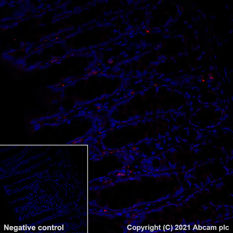 Immunohistochemistry (Formalin/PFA-fixed paraffin-embedded sections) - Alexa Fluor® 647 Anti-IL-12RB1 antibody [EPR23693-37] (AB282729)