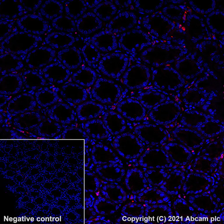 Immunohistochemistry (Formalin/PFA-fixed paraffin-embedded sections) - Alexa Fluor® 647 Anti-IL-12RB1 antibody [EPR23693-37] (AB282729)