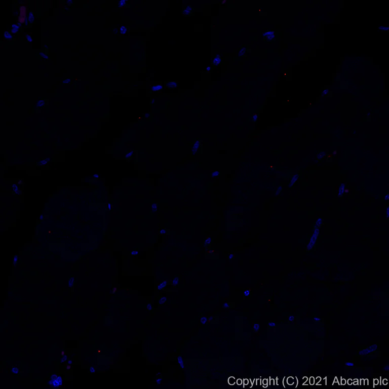 Immunohistochemistry (Formalin/PFA-fixed paraffin-embedded sections) - Alexa Fluor® 647 Anti-IL-12RB1 antibody [EPR23693-37] (AB282729)
