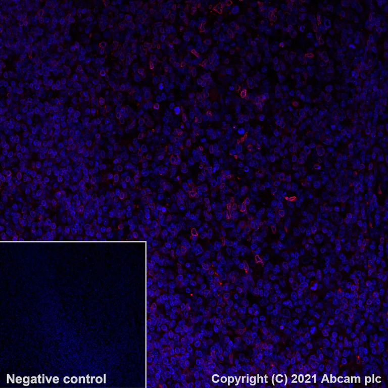 Immunohistochemistry (Formalin/PFA-fixed paraffin-embedded sections) - Alexa Fluor® 647 Anti-IL-12RB1 antibody [EPR23693-37] (AB282729)