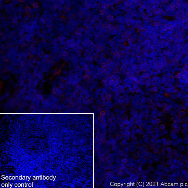 Immunohistochemistry (Frozen sections) - Alexa Fluor® 647 Anti-IL-12RB1 antibody [EPR23693-37] (AB282729)