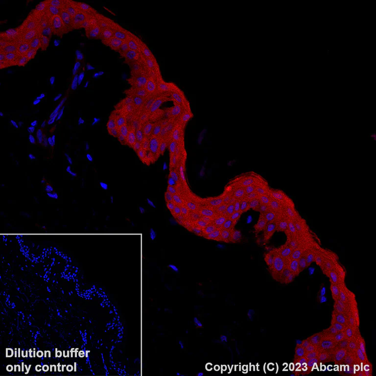 Immunohistochemistry (Formalin/PFA-fixed paraffin-embedded sections) - Alexa Fluor® 647 Anti-IL-1RA antibody [EPR26853-58] (AB315955)