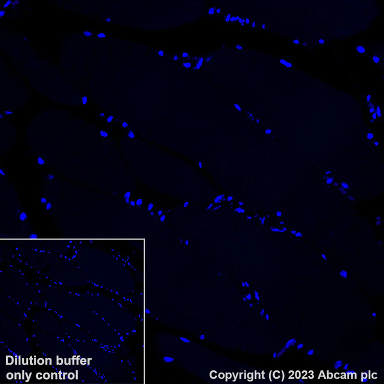 Immunohistochemistry (Formalin/PFA-fixed paraffin-embedded sections) - Alexa Fluor® 647 Anti-IL-1RA antibody [EPR26853-58] (AB315955)
