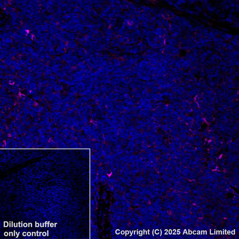 Immunohistochemistry (Formalin/PFA-fixed paraffin-embedded sections) - Alexa Fluor® 647 Anti-IL-4I1/LAO antibody [EPR26368-90] (AB325315)
