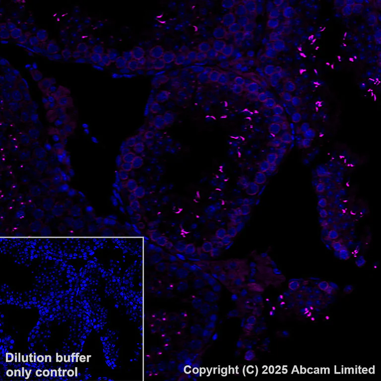 Immunohistochemistry (Formalin/PFA-fixed paraffin-embedded sections) - Alexa Fluor® 647 Anti-IL-4I1/LAO antibody [EPR26368-90] (AB325315)