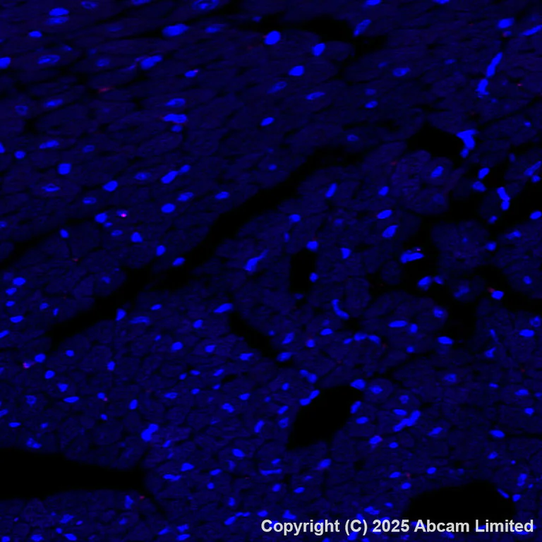 Immunohistochemistry (Formalin/PFA-fixed paraffin-embedded sections) - Alexa Fluor® 647 Anti-IL-4I1/LAO antibody [EPR26368-90] (AB325315)
