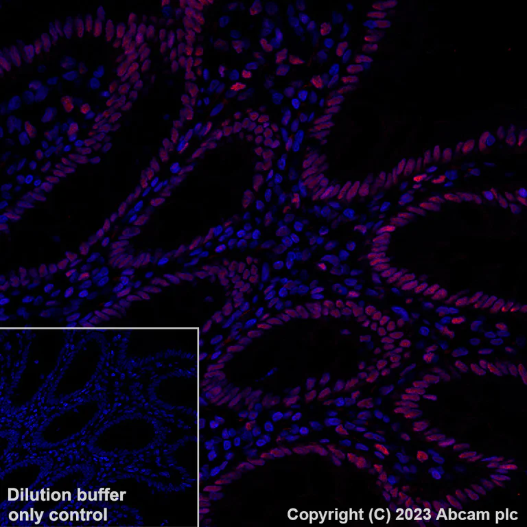 Immunohistochemistry (Formalin/PFA-fixed paraffin-embedded sections) - Alexa Fluor® 647 Anti-Importin subunit alpha antibody [EPR26346-53] (AB316342)