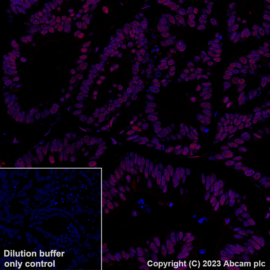 Immunohistochemistry (Formalin/PFA-fixed paraffin-embedded sections) - Alexa Fluor® 647 Anti-Importin subunit alpha antibody [EPR26346-53] (AB316342), expandable thumbnail