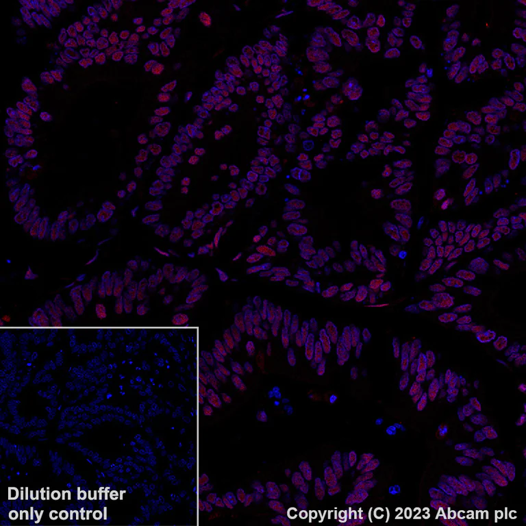 Immunohistochemistry (Formalin/PFA-fixed paraffin-embedded sections) - Alexa Fluor® 647 Anti-Importin subunit alpha antibody [EPR26346-53] (AB316342)