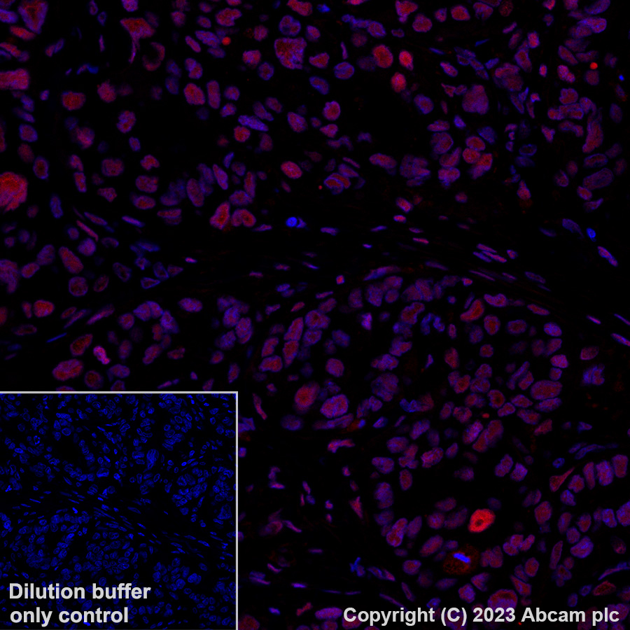 Immunohistochemistry (Formalin/PFA-fixed paraffin-embedded sections) - Alexa Fluor® 647 Anti-Importin subunit alpha antibody [EPR26346-53] (AB316342), expandable thumbnail