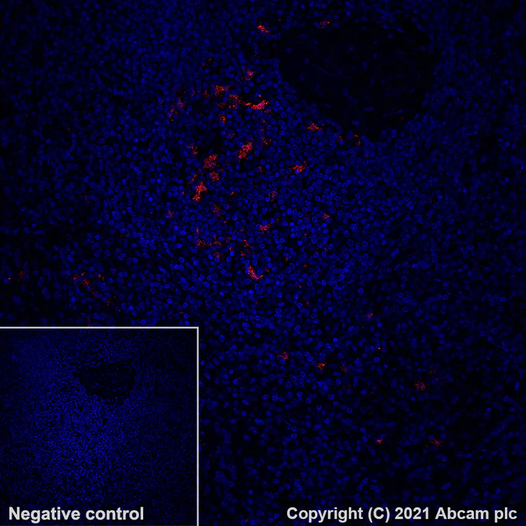 Immunohistochemistry (Formalin/PFA-fixed paraffin-embedded sections) - Alexa Fluor® 647 Anti-Indoleamine 2, 3-dioxygenase antibody [EPR20374] (AB281580)