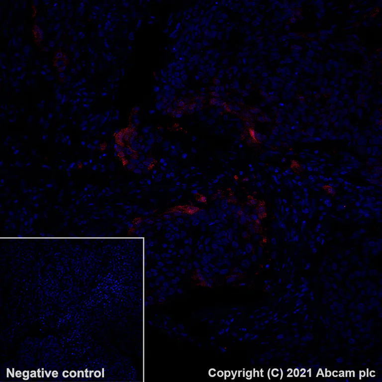 Immunohistochemistry (Formalin/PFA-fixed paraffin-embedded sections) - Alexa Fluor® 647 Anti-Indoleamine 2, 3-dioxygenase antibody [EPR20374] (AB281580)
