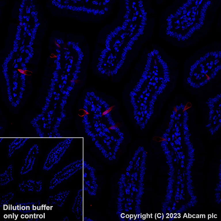 Immunohistochemistry (Formalin/PFA-fixed paraffin-embedded sections) - Alexa Fluor® 647 Anti-Indoleamine 2, 3-dioxygenase antibody [EPR28349-89] (AB317668)
