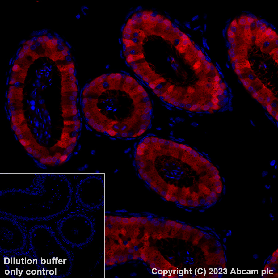 Immunohistochemistry (Formalin/PFA-fixed paraffin-embedded sections) - Alexa Fluor® 647 Anti-Indoleamine 2, 3-dioxygenase antibody [EPR28349-89] (AB317668), expandable thumbnail