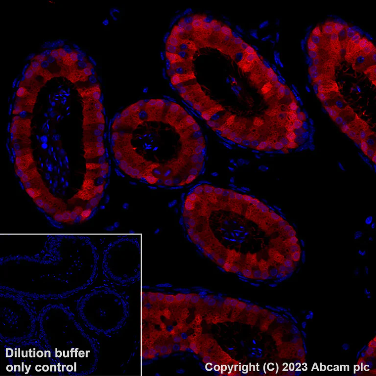 Immunohistochemistry (Formalin/PFA-fixed paraffin-embedded sections) - Alexa Fluor® 647 Anti-Indoleamine 2, 3-dioxygenase antibody [EPR28349-89] (AB317668)
