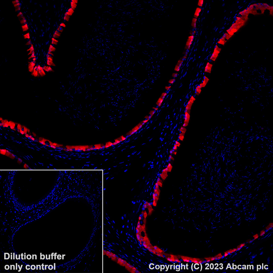 Immunohistochemistry (Formalin/PFA-fixed paraffin-embedded sections) - Alexa Fluor® 647 Anti-Indoleamine 2, 3-dioxygenase antibody [EPR28349-89] (AB317668), expandable thumbnail