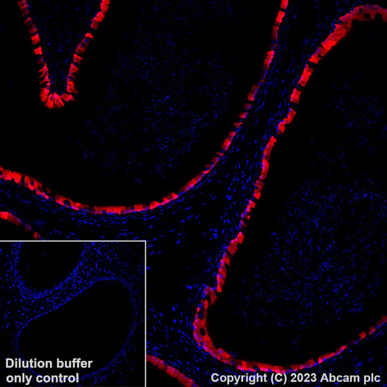 Immunohistochemistry (Formalin/PFA-fixed paraffin-embedded sections) - Alexa Fluor® 647 Anti-Indoleamine 2, 3-dioxygenase antibody [EPR28349-89] (AB317668)