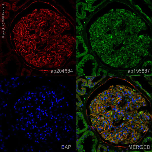 Immunohistochemistry (Formalin/PFA-fixed paraffin-embedded sections) - Alexa Fluor® 647 Anti-Integrin alpha V antibody [EPR16800] (AB204684)