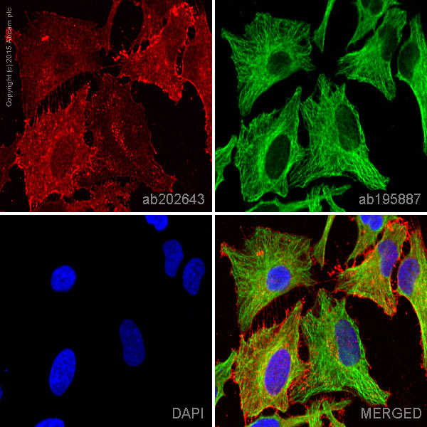 Immunocytochemistry/ Immunofluorescence - Alexa Fluor® 647 Anti-Integrin beta 1 antibody [12G10] (AB202643), expandable thumbnail