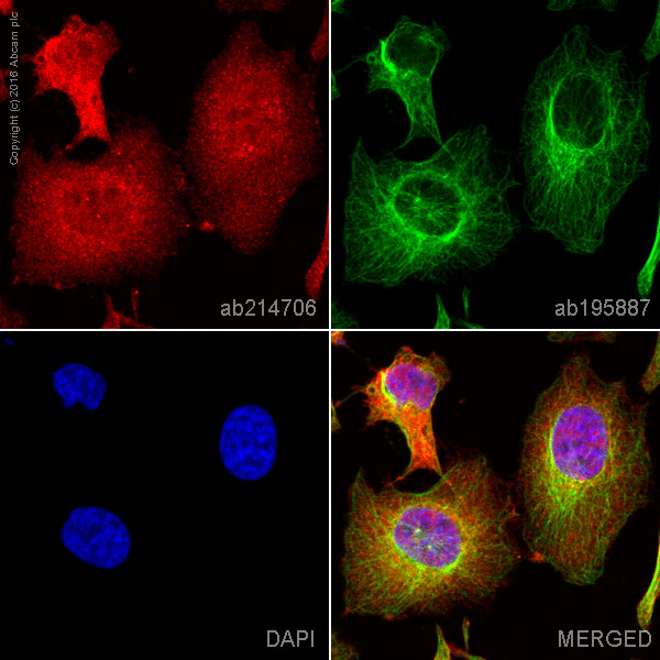 Immunocytochemistry/ Immunofluorescence - Alexa Fluor® 647 Anti-Integrin beta 1 antibody [EPR1040Y] (AB214706), expandable thumbnail