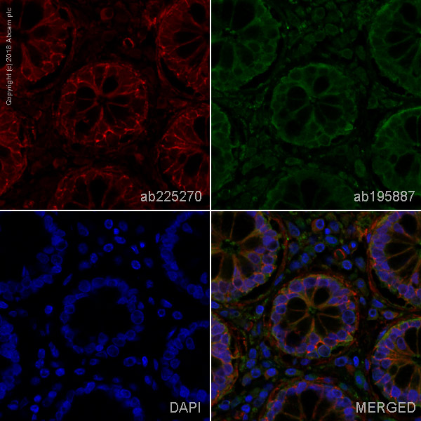 Immunohistochemistry (Formalin/PFA-fixed paraffin-embedded sections) - Alexa Fluor® 647 Anti-Integrin beta 1 antibody [EPR16895] (AB225270), expandable thumbnail