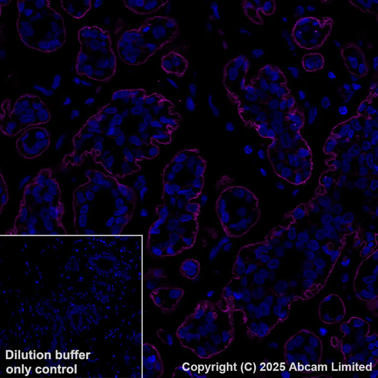 Immunohistochemistry (Formalin/PFA-fixed paraffin-embedded sections) - Alexa Fluor® 647 Anti-Integrin beta 4 antibody [EPR17517] (AB323997)