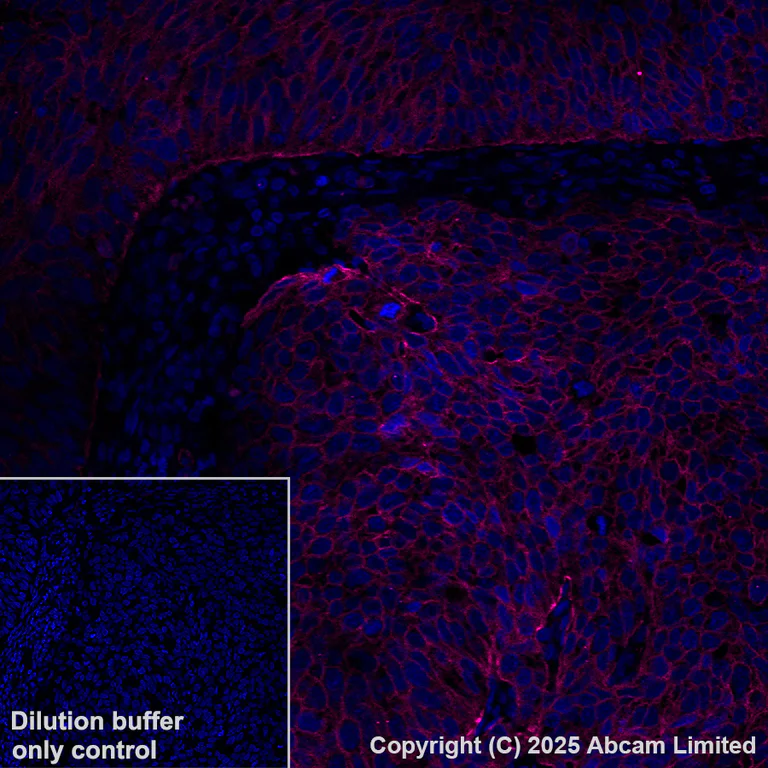 Immunohistochemistry (Formalin/PFA-fixed paraffin-embedded sections) - Alexa Fluor® 647 Anti-Integrin beta 4 antibody [EPR17517] (AB323997)