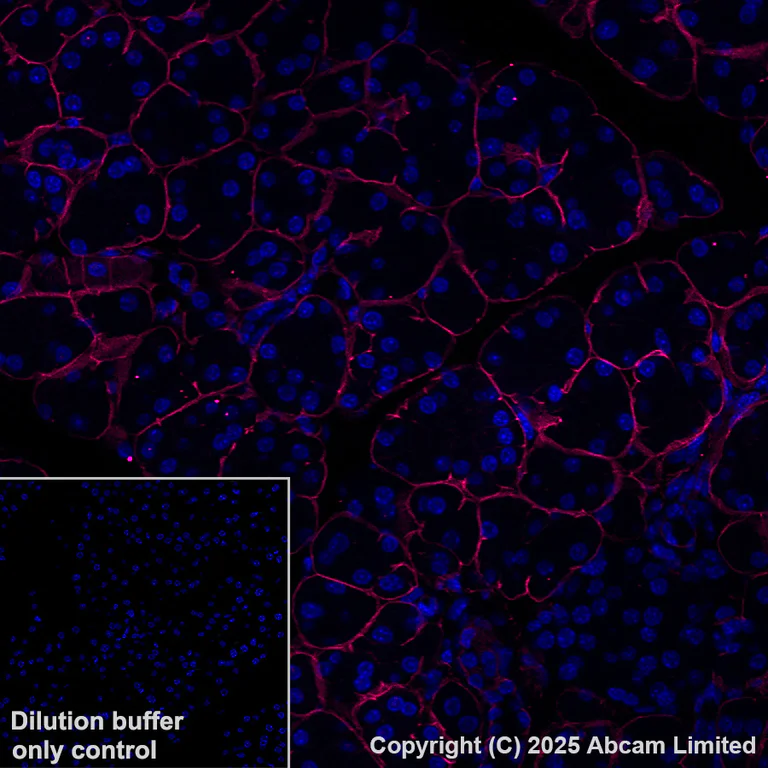 Immunohistochemistry (Formalin/PFA-fixed paraffin-embedded sections) - Alexa Fluor® 647 Anti-Integrin beta 4 antibody [EPR17517] (AB323997)
