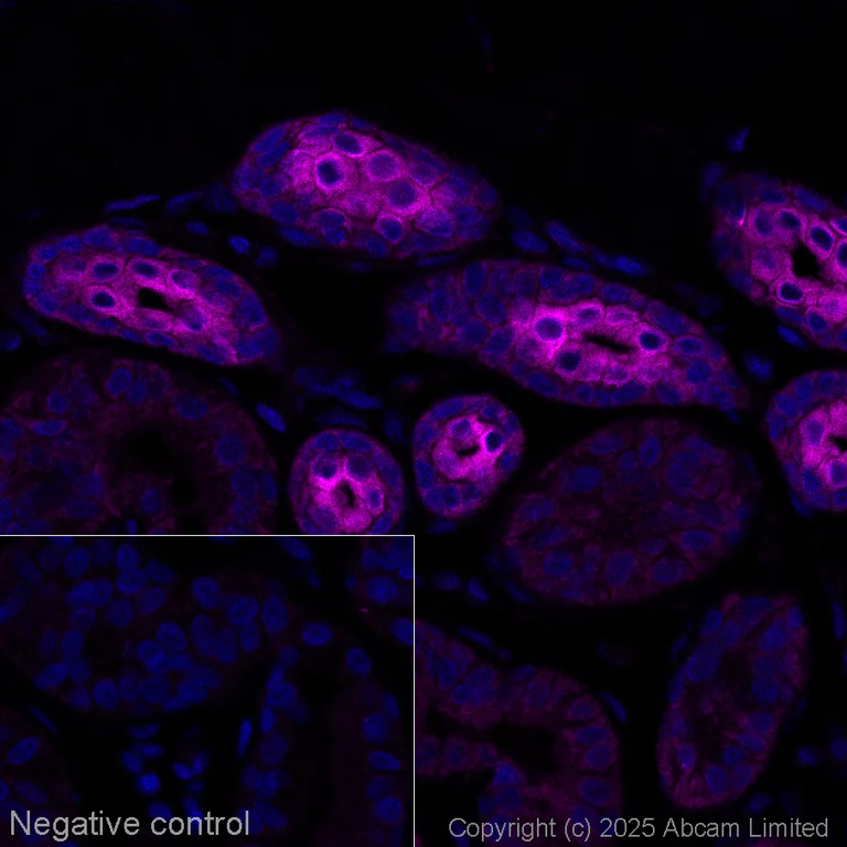 Immunohistochemistry (Formalin/PFA-fixed paraffin-embedded sections) - Alexa Fluor® 647 Anti-Interferon beta antibody [EPR25257-135] (AB324447)
