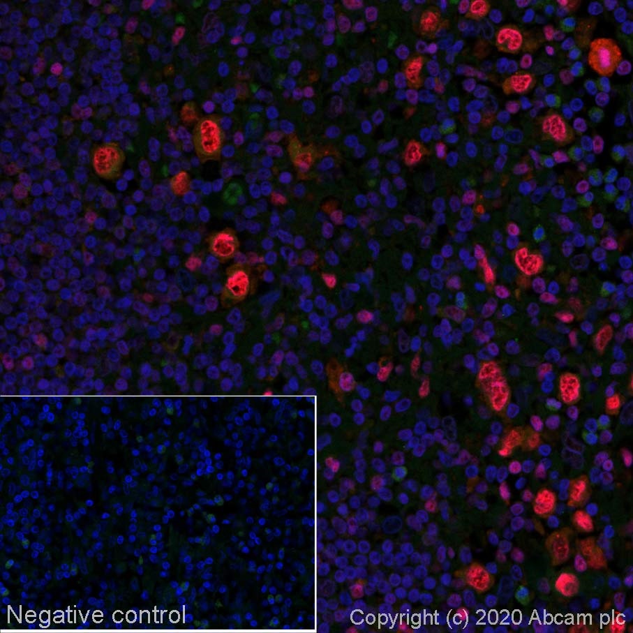 Immunohistochemistry (Formalin/PFA-fixed paraffin-embedded sections) - Alexa Fluor® 647 Anti-IRF4 antibody [EP5699] (AB252024)