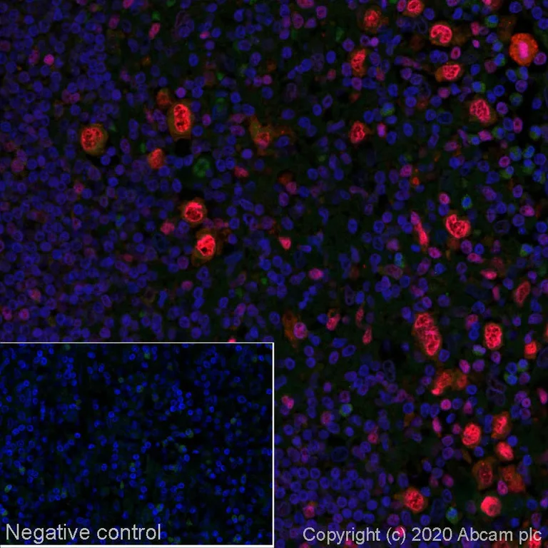 Immunohistochemistry (Formalin/PFA-fixed paraffin-embedded sections) - Alexa Fluor® 647 Anti-IRF4 antibody [EP5699] (AB252024)