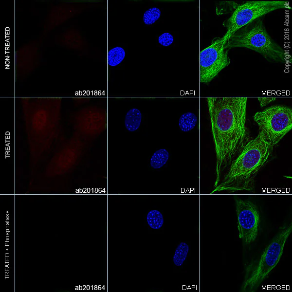 Immunocytochemistry/ Immunofluorescence - Alexa Fluor® 647 Anti-JNK1 + JNK2 + JNK3 (phospho T183+T183+T221) antibody [EPR5693] (AB201864)
