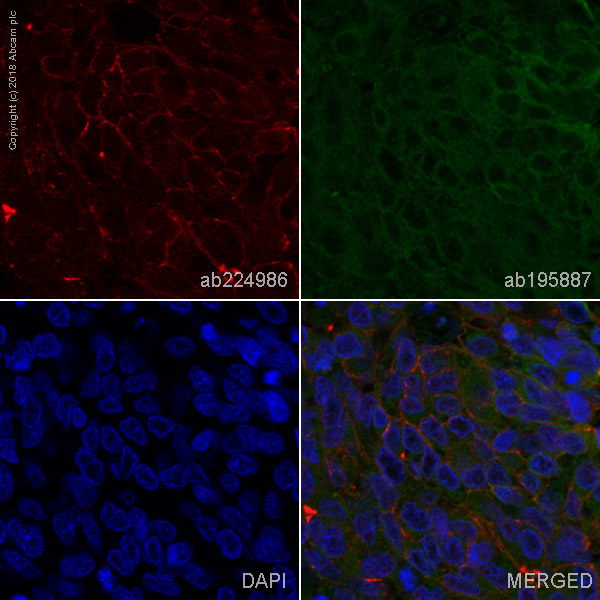 Immunohistochemistry (Formalin/PFA-fixed paraffin-embedded sections) - Alexa Fluor® 647 Anti-Junctional Adhesion Molecule 1/JAM-A antibody [EP1042Y] (AB224986)