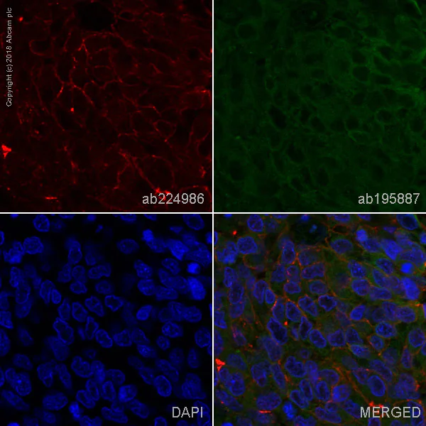 Immunohistochemistry (Formalin/PFA-fixed paraffin-embedded sections) - Alexa Fluor® 647 Anti-Junctional Adhesion Molecule 1/JAM-A antibody [EP1042Y] (AB224986)