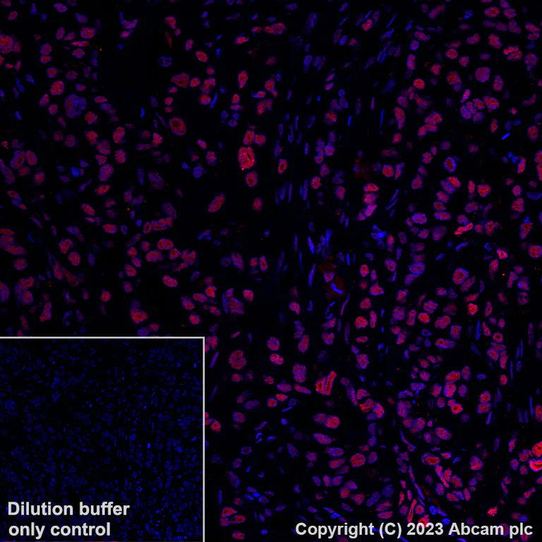 Immunohistochemistry (Formalin/PFA-fixed paraffin-embedded sections) - Alexa Fluor® 647 Anti-KAP1 antibody [EPR5216] (AB314593)