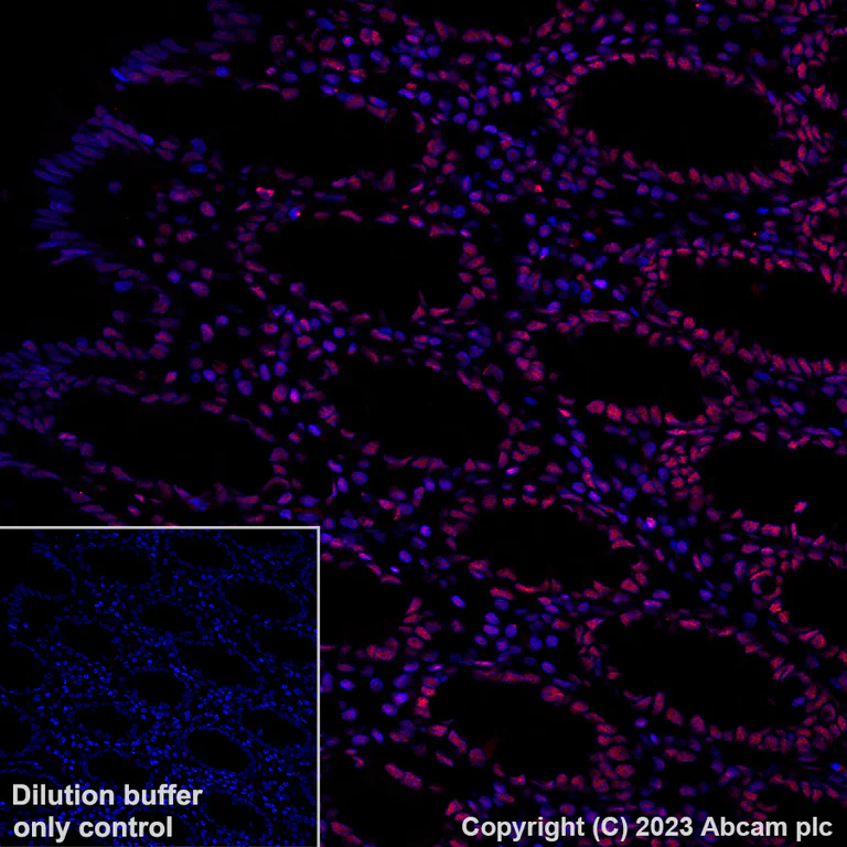 Immunohistochemistry (Formalin/PFA-fixed paraffin-embedded sections) - Alexa Fluor® 647 Anti-KAP1 antibody [EPR5216] (AB314593)