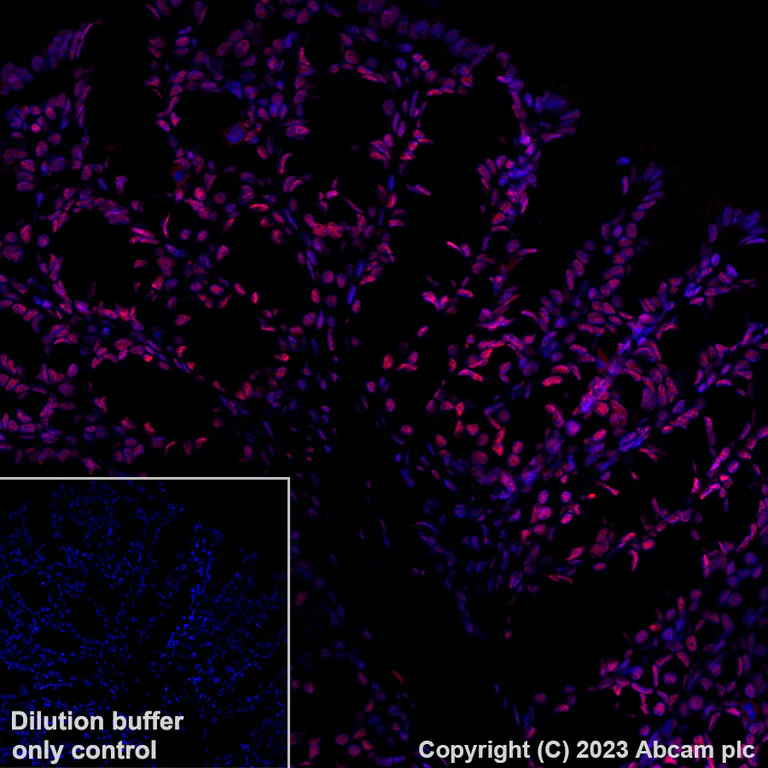 Immunohistochemistry (Formalin/PFA-fixed paraffin-embedded sections) - Alexa Fluor® 647 Anti-KAP1 antibody [EPR5216] (AB314593)