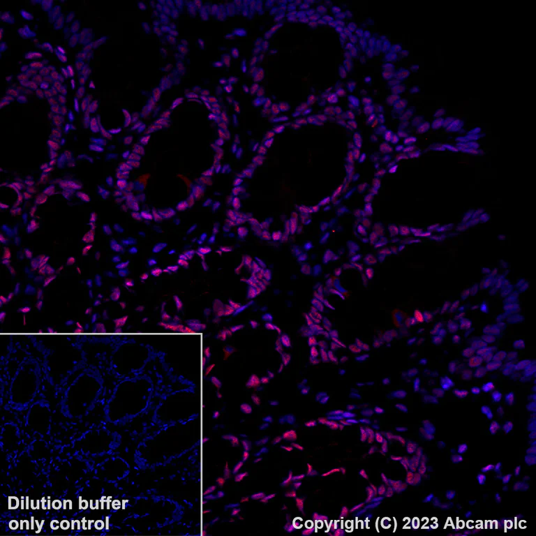 Immunohistochemistry (Formalin/PFA-fixed paraffin-embedded sections) - Alexa Fluor® 647 Anti-KAP1 antibody [EPR5216] (AB314593)