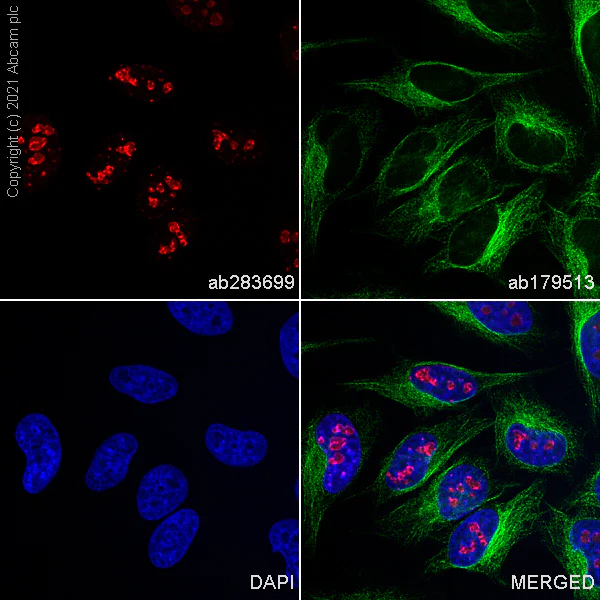 Immunocytochemistry/ Immunofluorescence - Alexa Fluor® 647 Anti-Ki67 antibody [B56] (AB283699)