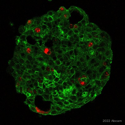 Immunocytochemistry/ Immunofluorescence - Alexa Fluor® 647 Anti-Ki67 antibody [EPR3610] (AB196907)